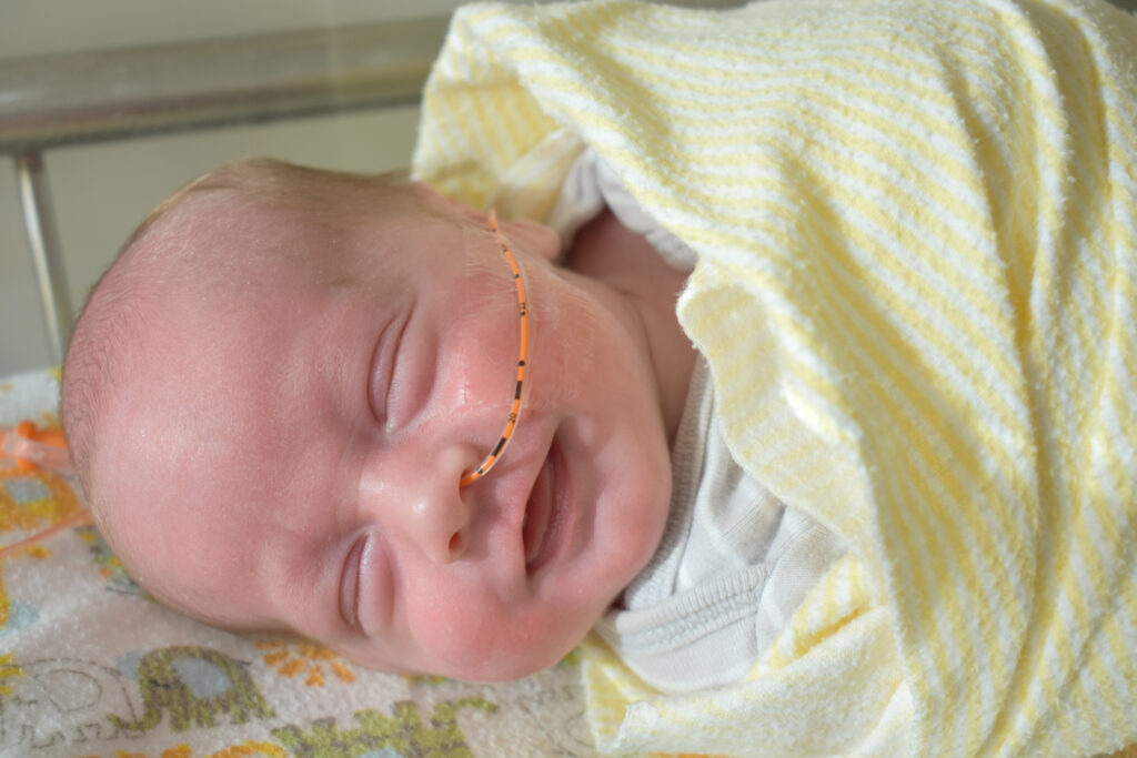 ما يمكن توقعه بعد إجراء NG Tube