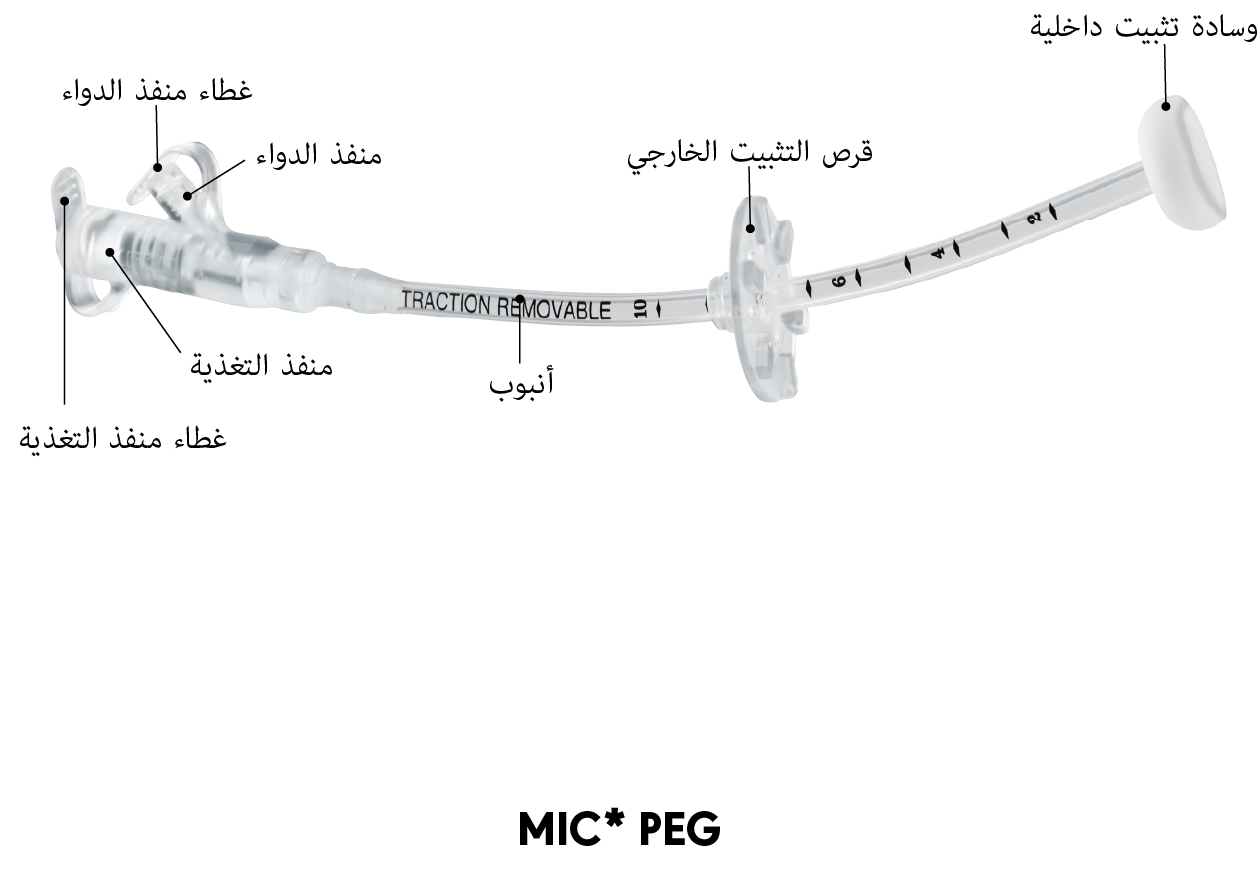 MIC* مخطط أنبوب PEG
